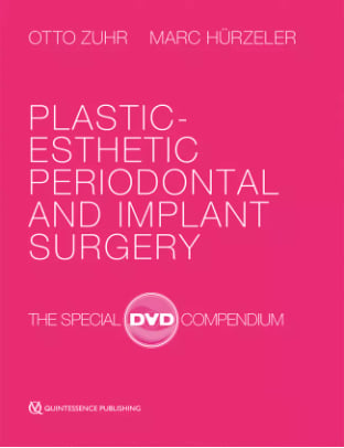Plastic-Esthetic Periodontal and Implant Surgery The Special DVD Compendium