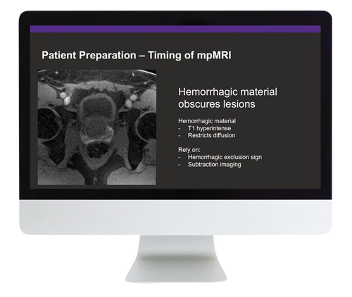 Prostate MR Case Review 2024