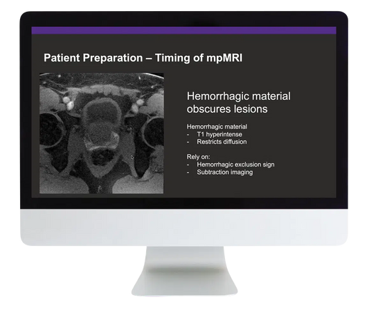 Prostate MR Case Review 2024