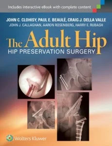 The Adult Hip: Hip Preservation Surgery (Original PDF from Publisher)