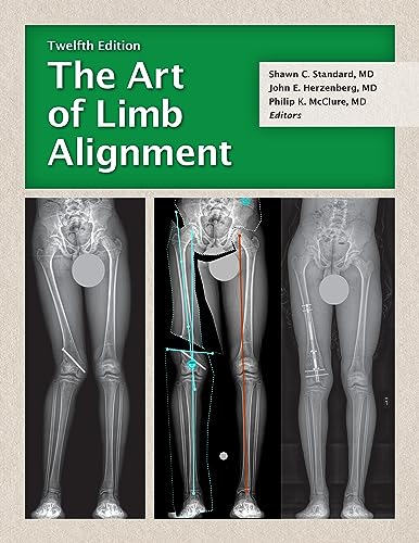 The Art of Limb Alignment, 12th edition (Original PDF from Publisher)