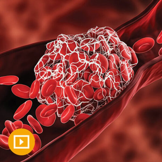 Thrombosis & Thromboembolism 2022