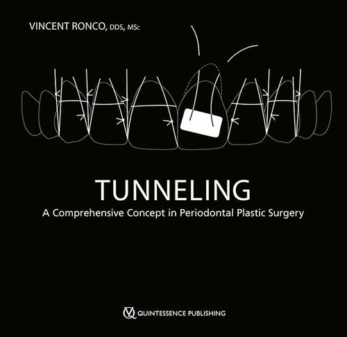 Tunneling A Comprehensive Concept in Periodontal Plastic Surgery