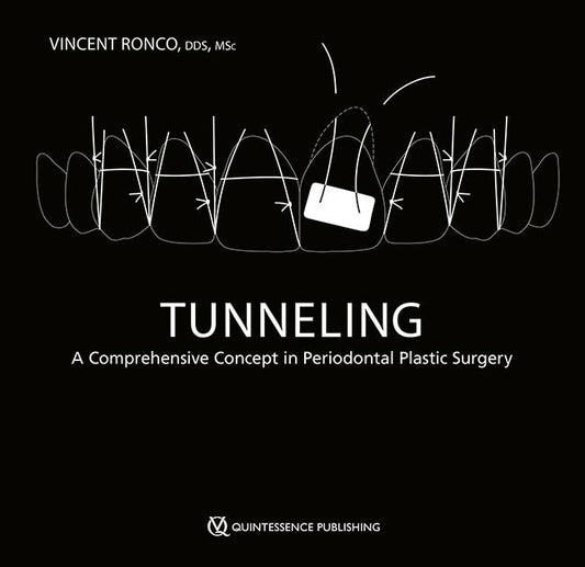 Tunneling A Comprehensive Concept in Periodontal Plastic Surgery