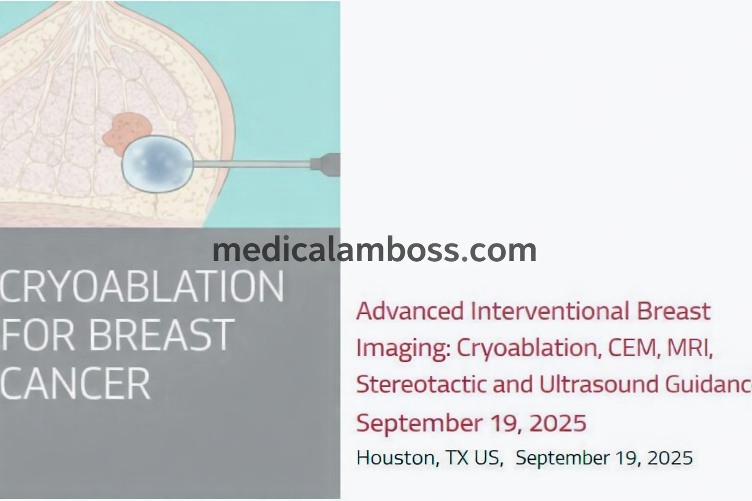 Houston Methodist Advanced Interventional Breast Imaging 2025