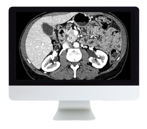 ARRS Gastrointestinal Imaging Online Course 2019 (CME VIDEOS)