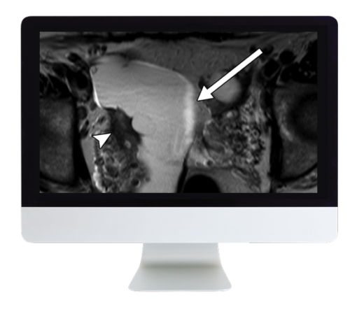 ARRS Women’s Imaging 2019 (CME VIDEOS)