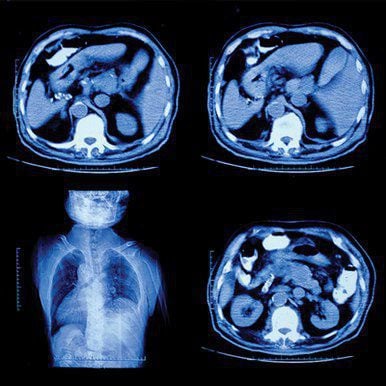 UCSF Radiology Clinical Update 2023