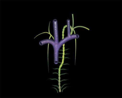 MRIOnline Mastery Series: Brachial Plexus 2022