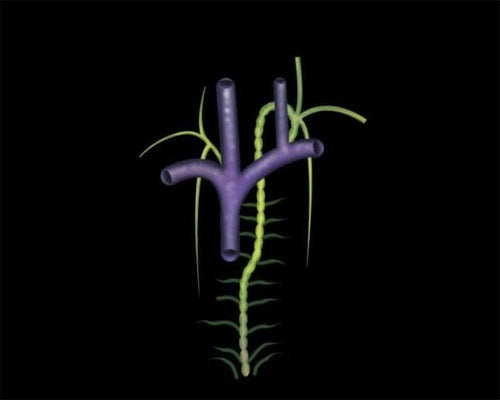 MRIOnline Mastery Series: Brachial Plexus 2022