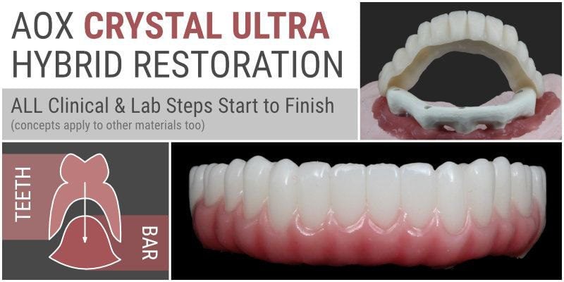 Ripeglobal A to Z of Porcelain Laminate Veneers (Copy)