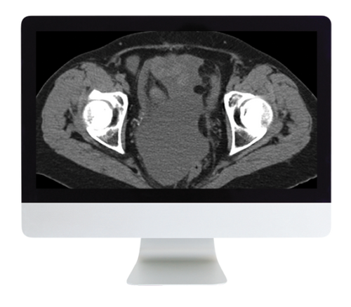 Radiologic Reasoning: A Rapid-Fire Multispecialty Review 2018 (ARRS VIDEOS) (CME VIDEOS)