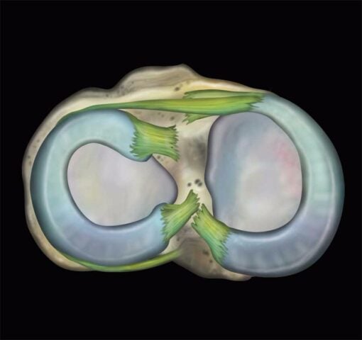 MRI Online MRI Mastery Series Elbow 2021