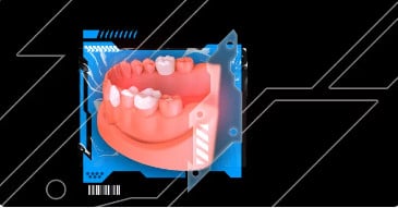 OHI-S Veneers, inlay, onlay, crowns: full protocols
